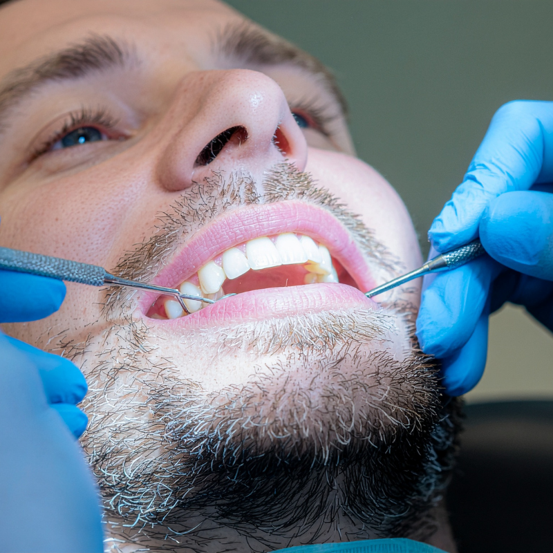 This image for Image Layouts addon